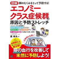 図解 エコノミークラス症候群の原因と予防ストレッチ