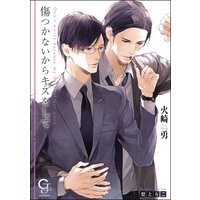 傷つかないからキスをして